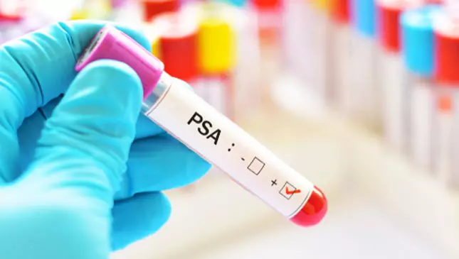 exame de PSA para detectar próstata aumentada